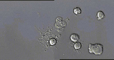 在成千上万倍的显微镜地下看细菌的生长gif图片